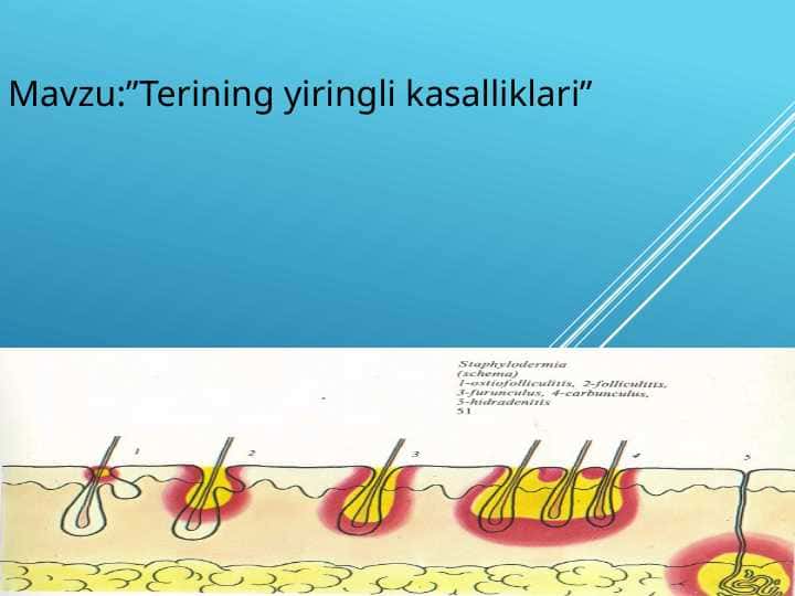 Terining yiringli kasalliklari