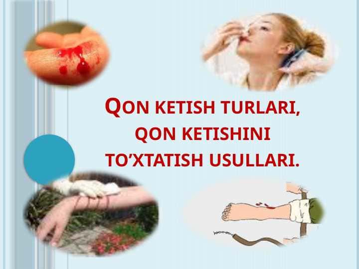 Qon ketish turlari, qon ketishini to’xtatish usullari