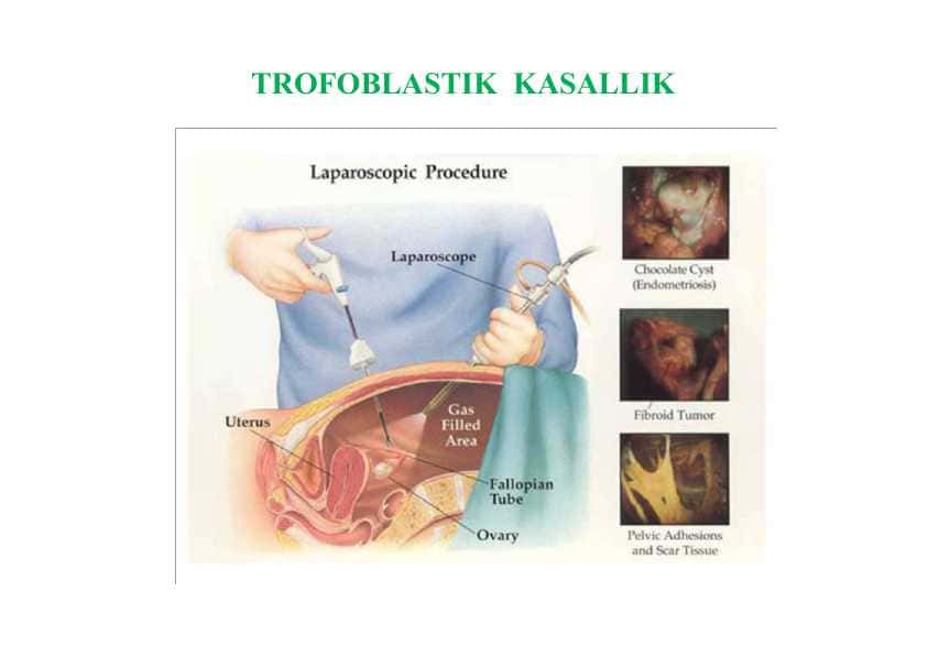 TROFOBLASTIK KASALLIK