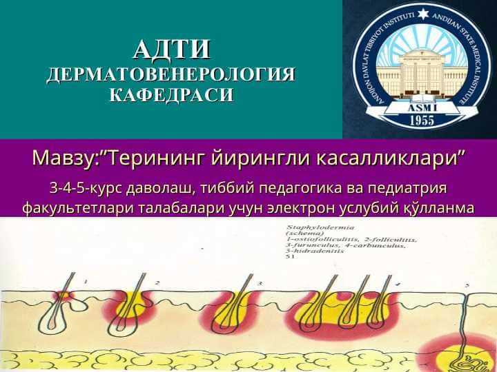 ТЕРИНИНГ ЙИРИНГЛИ КАСАЛЛИКЛАРИ-ПИОДЕРМИТЛАР - TERINING YIRINGLI KASALLIKLARI-PIODERMITLAR