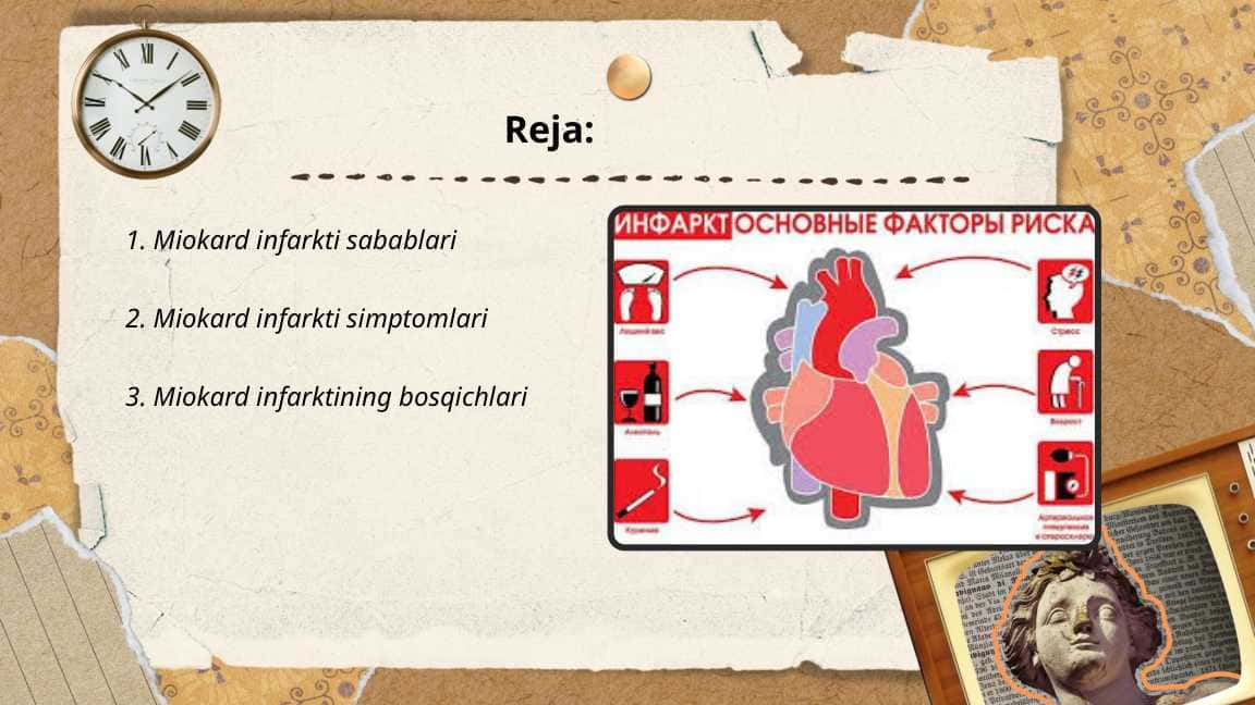 Miokard infarkti