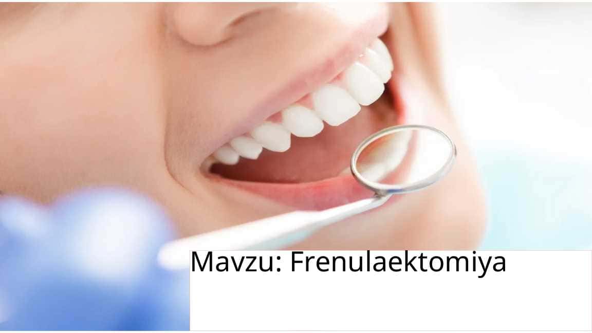 Frenulaektomiya