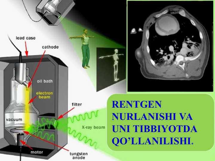RENTGEN NURLANISHI VA UNI TIBBIYOTDA QO’LLANILISHI. Рентген нурланиш