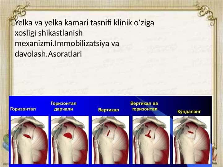 Yelka va yelka kamari tasnifi klinik oʻziga xosligi shikastlanish mexanizmi.Immobilizatsiya va davolash.Asoratlari