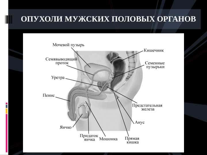 ОПУХОЛИ МУЖСКИХ ПОЛОВЫХ ОРГАНОВ