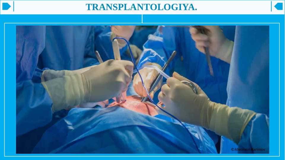 TRANSPLANTOLOGIYA