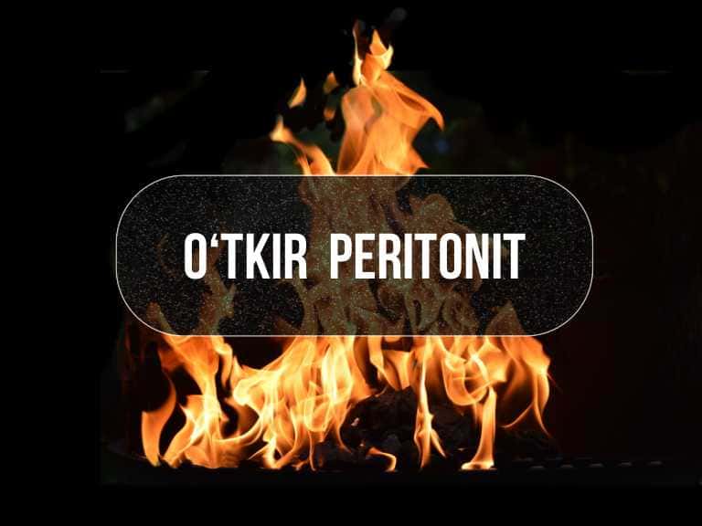 O‘tkir peritonit