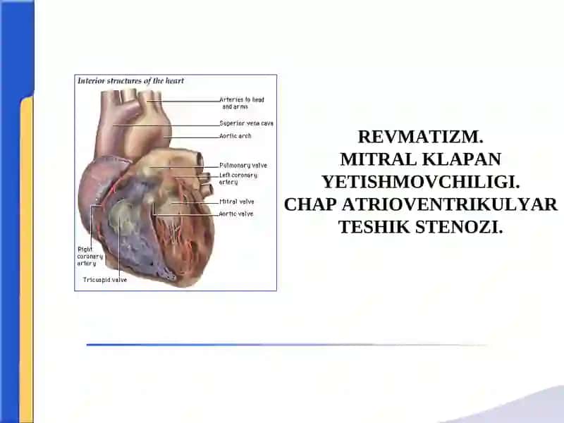 REVMATIZM.MITRAL KLAPAN YETISHMOVCHILIGI.CHAP ATRIOVENTRIKULYAR TESHIK STENOZІ.