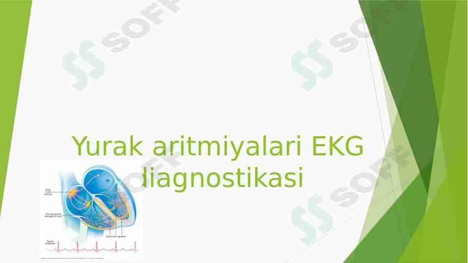 yurak aritmiyalari EKG diagnostikasi