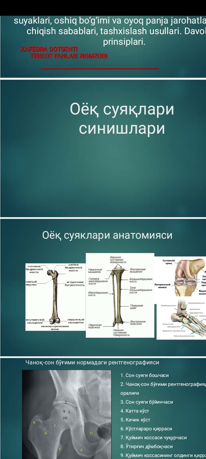 Оёқ суяқлари синишлари