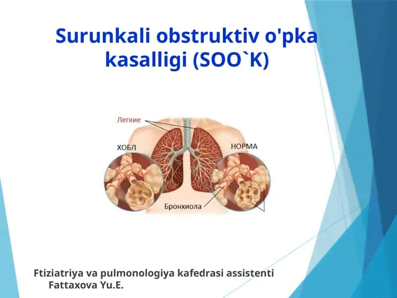 Surunkali obstruktiv o'pka kasalligi(SOO`K)