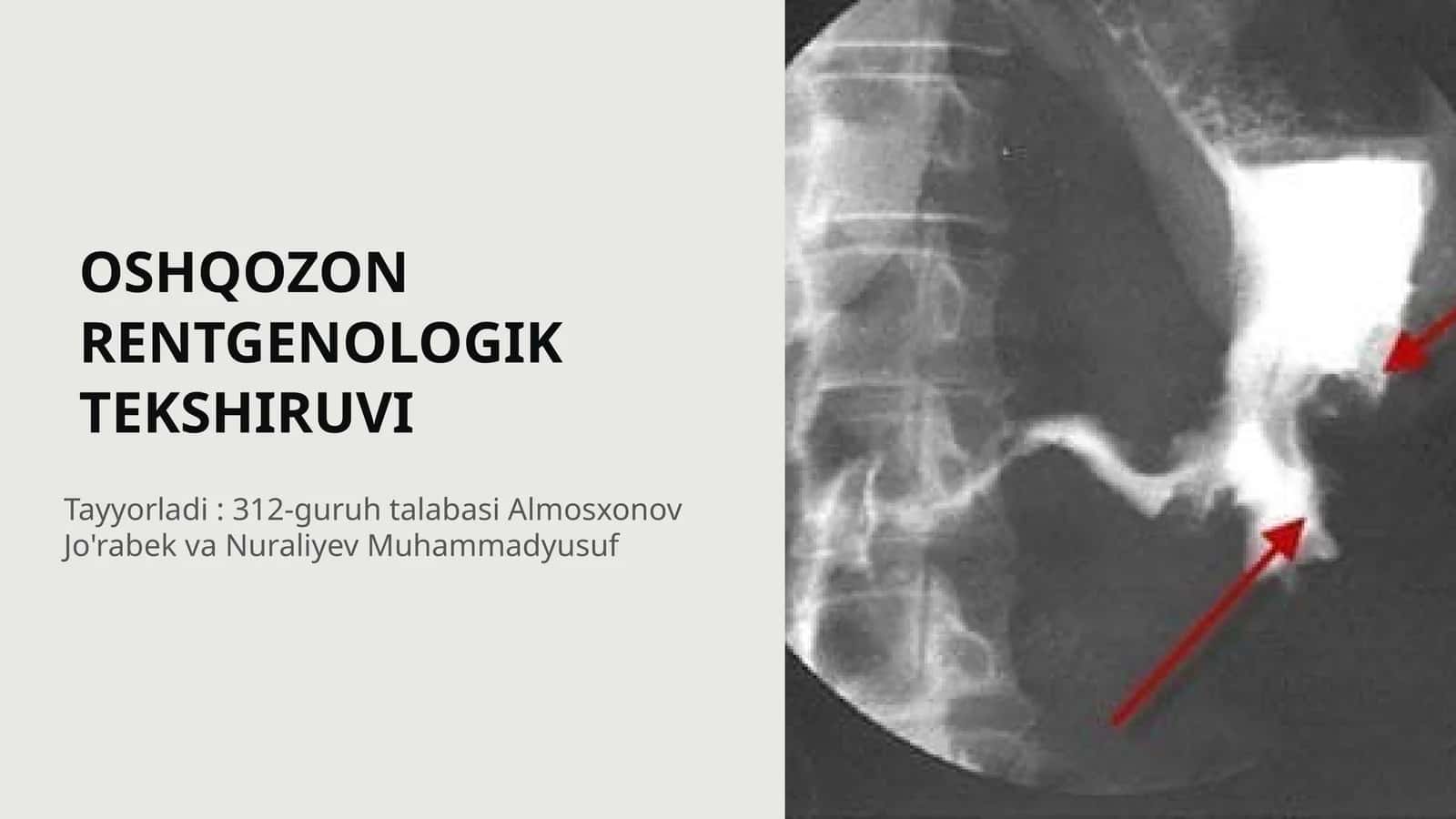 OSHQOZON RENTGENOLOGIK TEKSHIRUVI