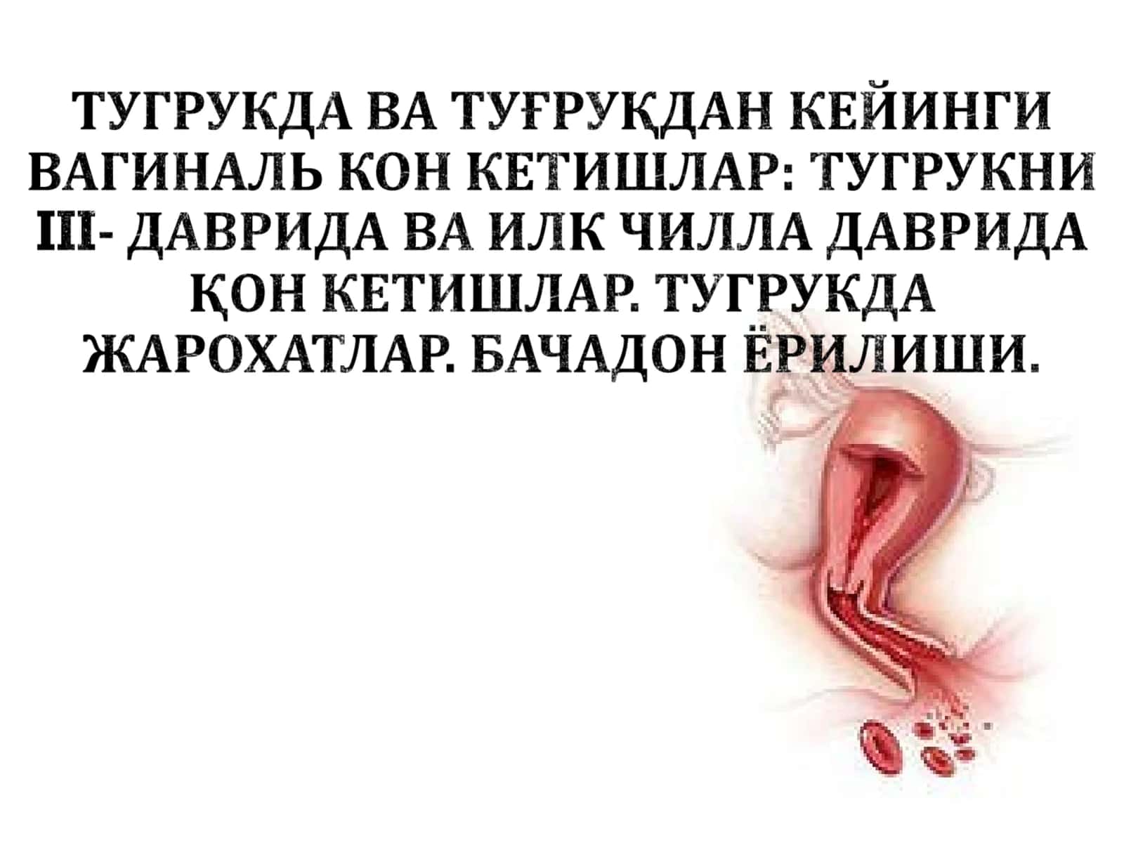 Туғруқдан кейинги қон кетиши