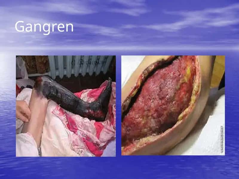Gangren