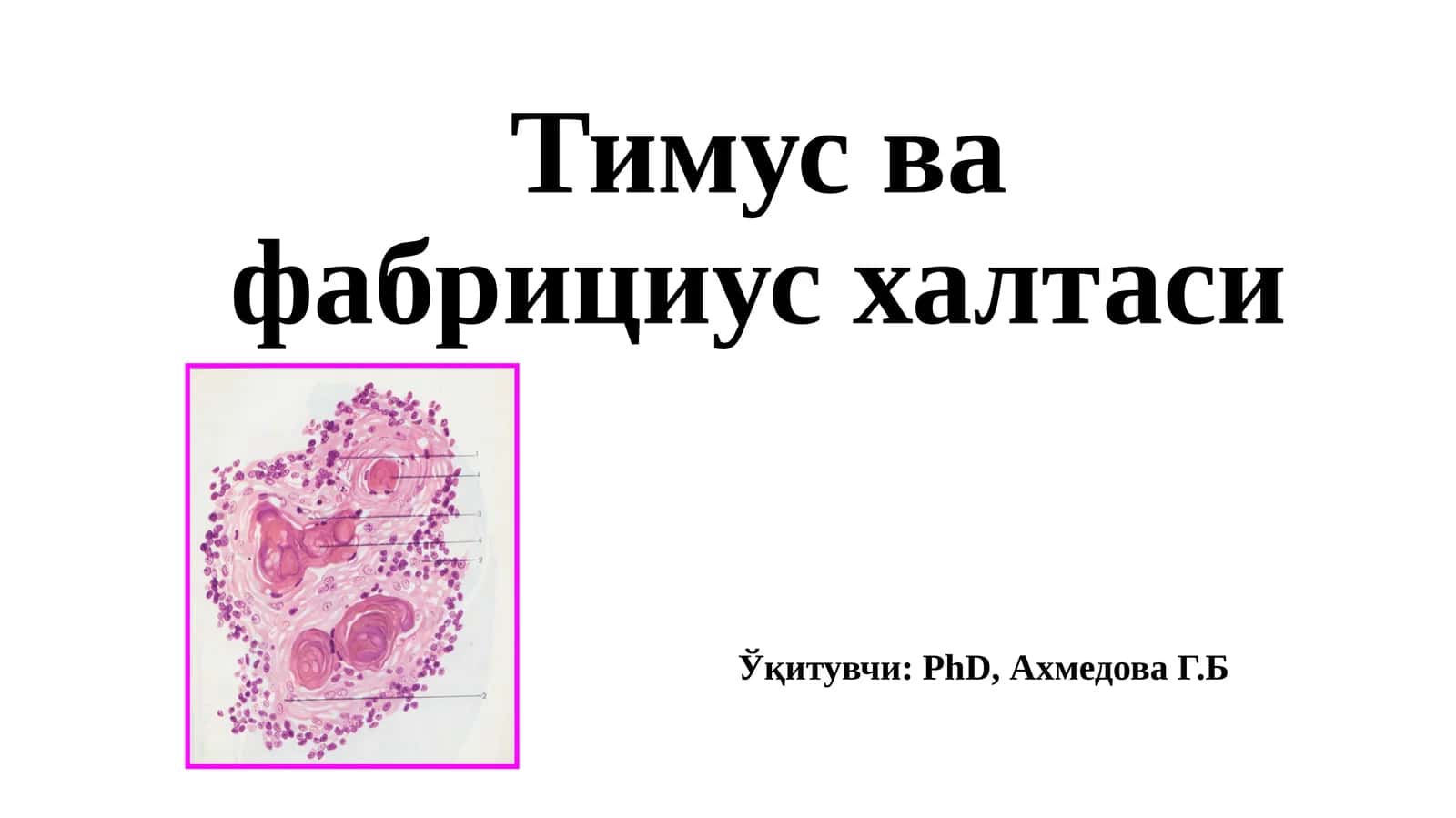 Тимус вафабрицияси