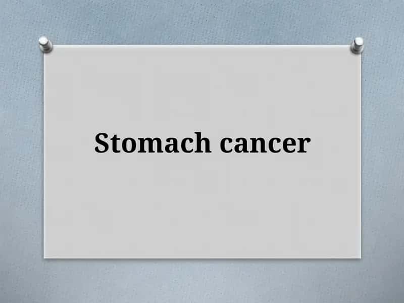 Stomach cancer