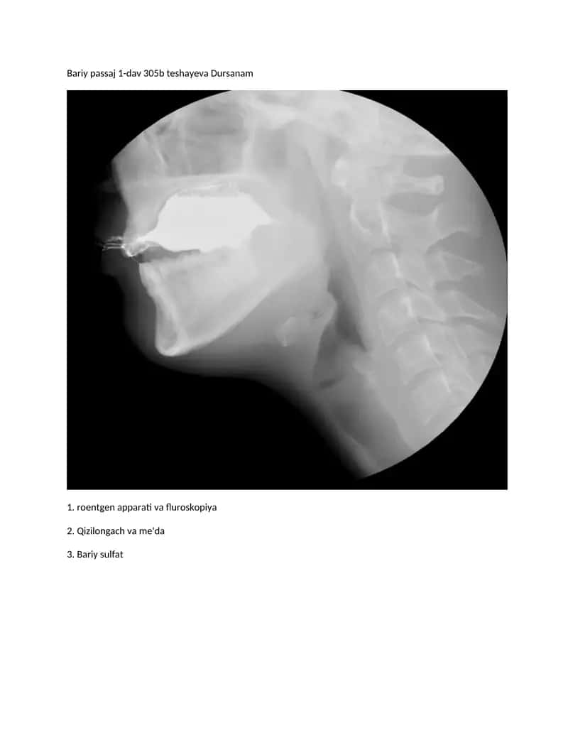 Roentgen apparati va fluroskopiya