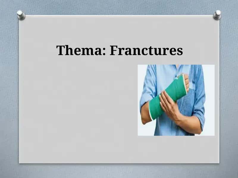 Bone fracture