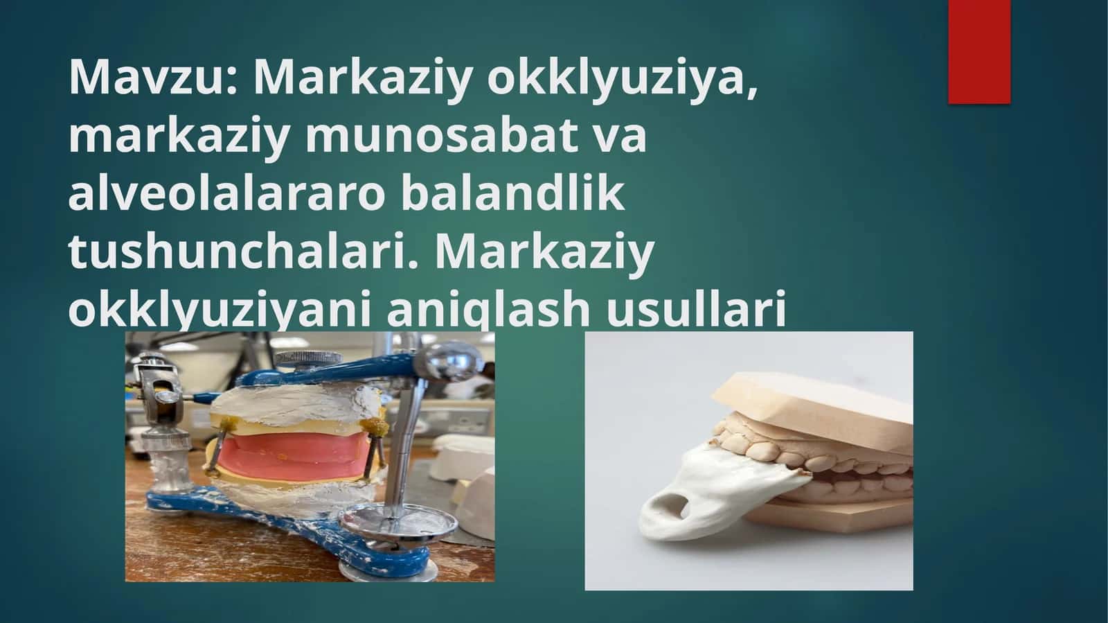 Markaziy okklyuziya