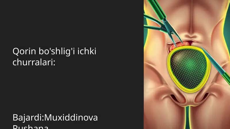 Qorin bo'shlig'i ichki churralari