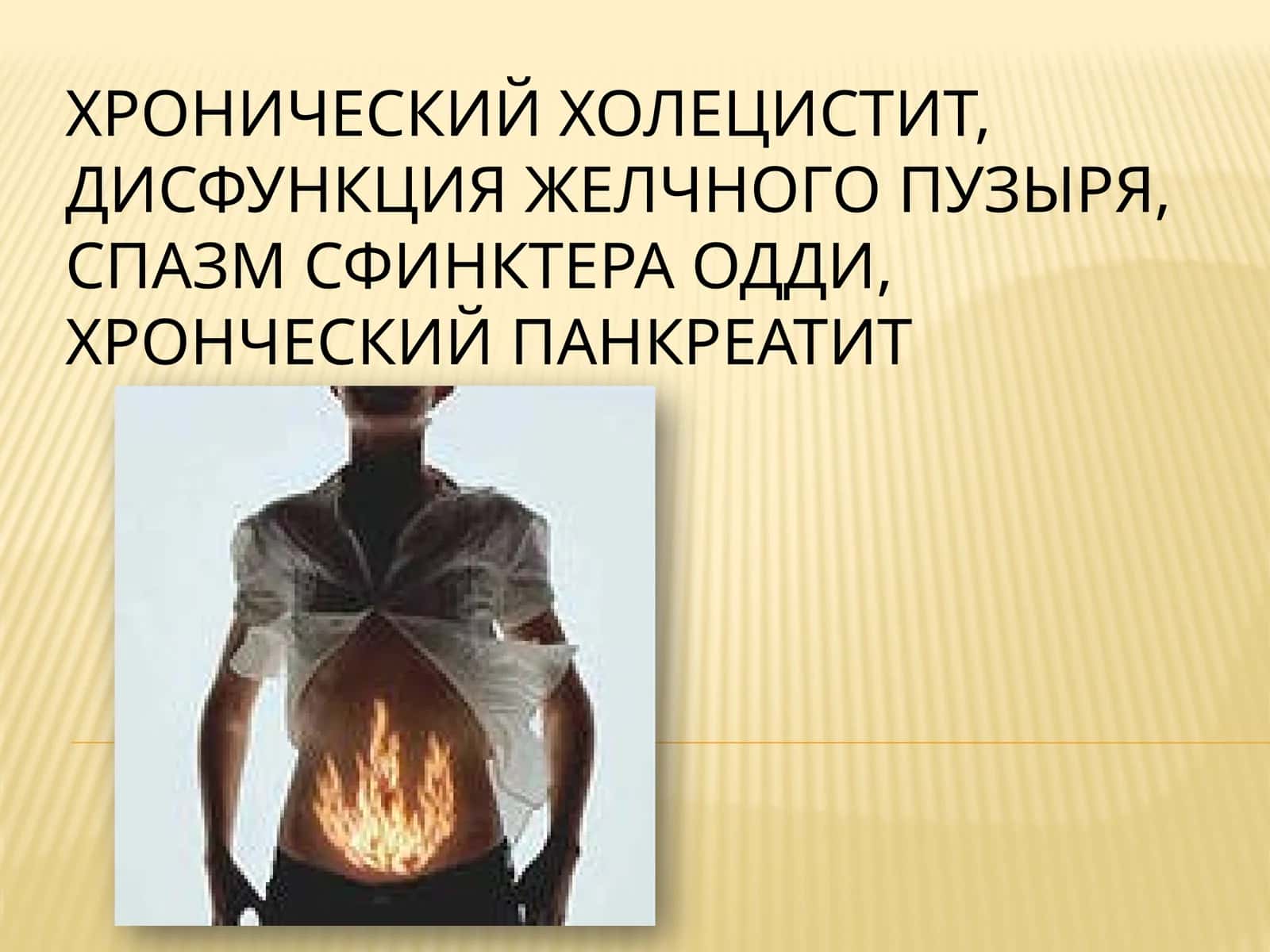 Хронический холецистит, дисфункция желчного пузыря, Спазм сфинктера Одди, хронический панкреатит