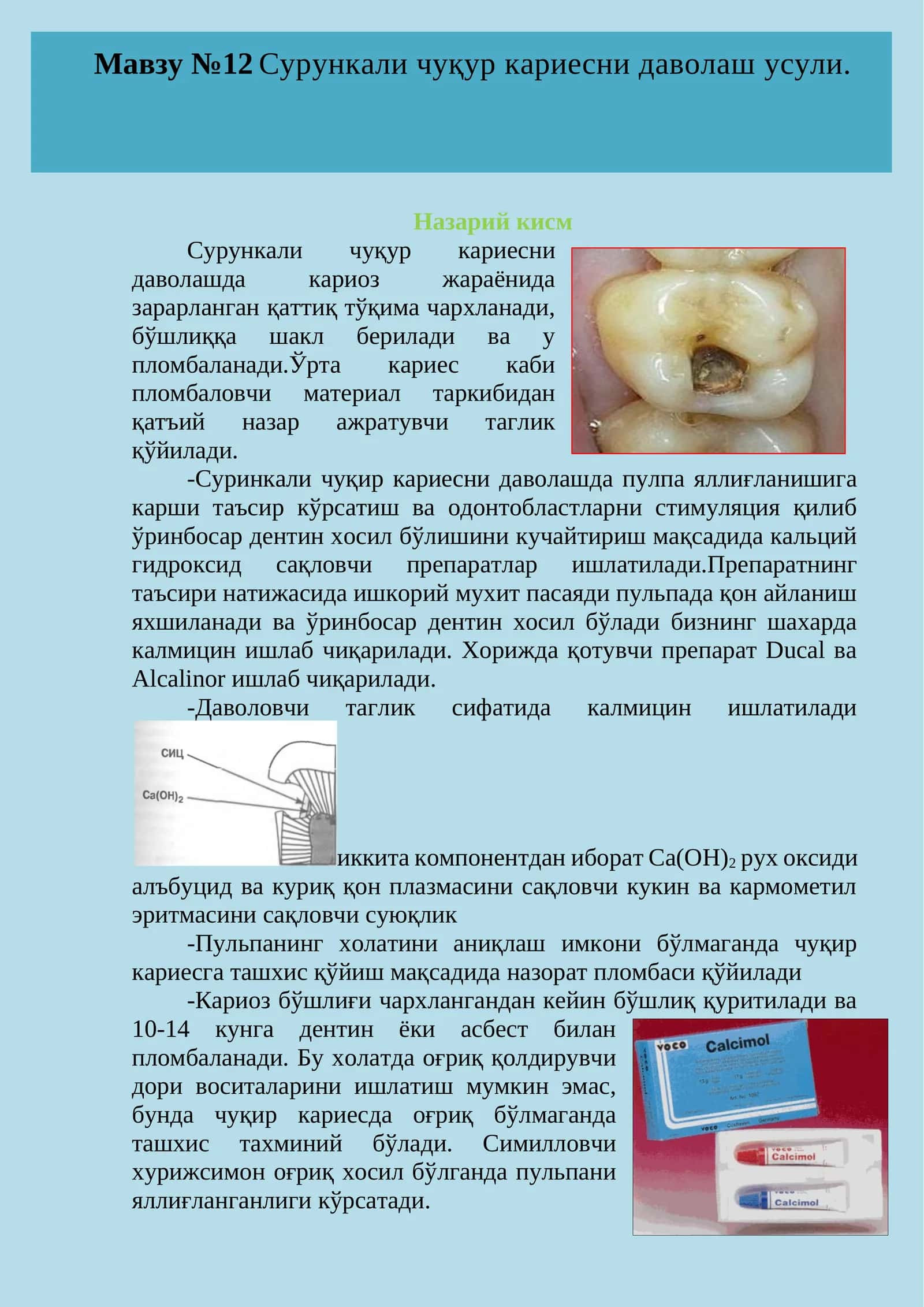 Мавзу №12 Сурункали чуқур кариесни даволаш усули