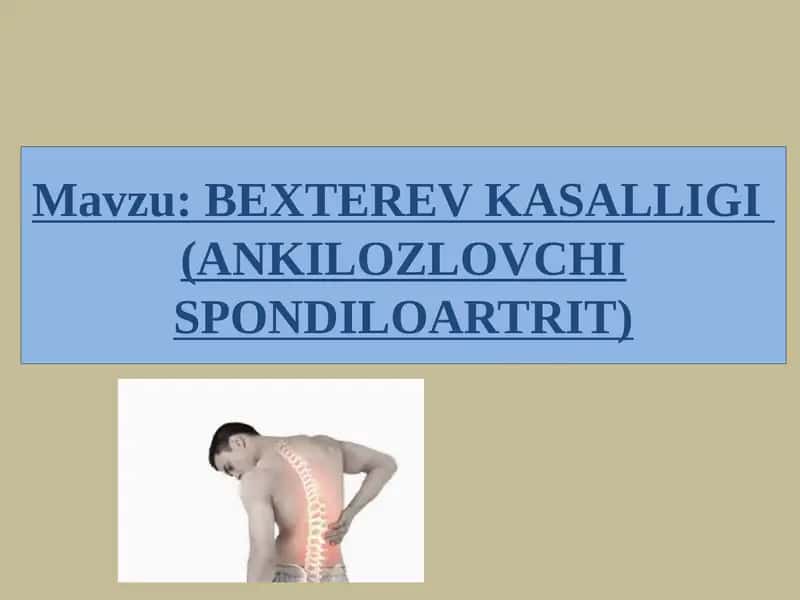 Bexterev kasalligi (ANKILOZLOVCHI SPONDILOARTRIT)