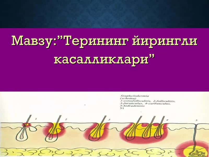 Терининг йирингли касалликлари