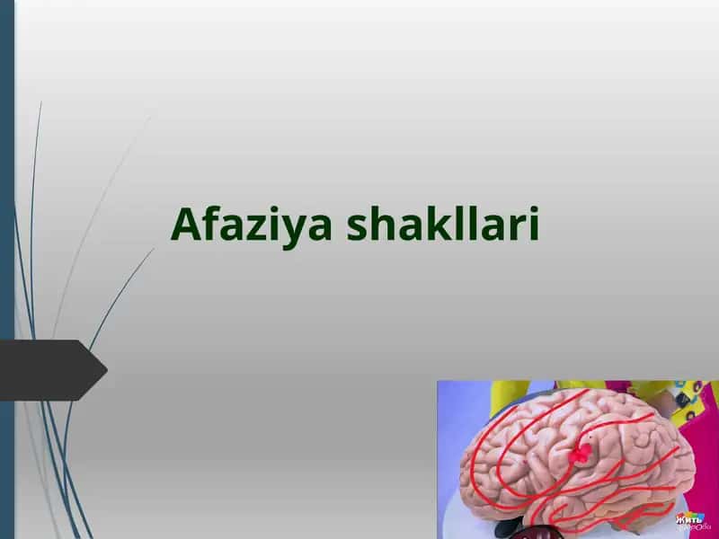 Аfaziya klassifikatsiyalari