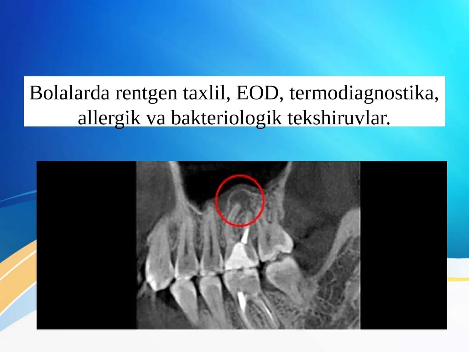 Bolalarda rentgen taxlil, EOD, termodiagnostika, allergik va bakteriologik tekshiruvlar.