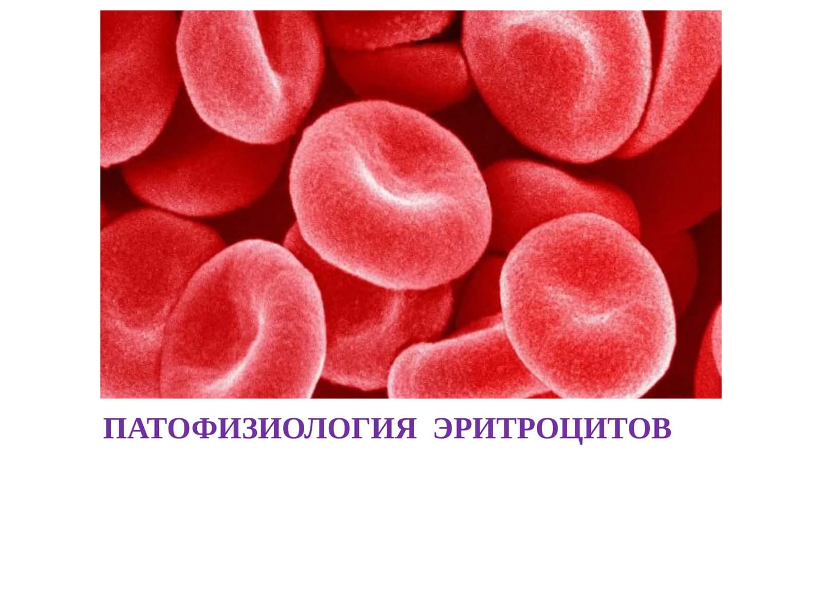 ПАТОФИЗИОЛОГИЯ ЭРИТРОЦИТОВ