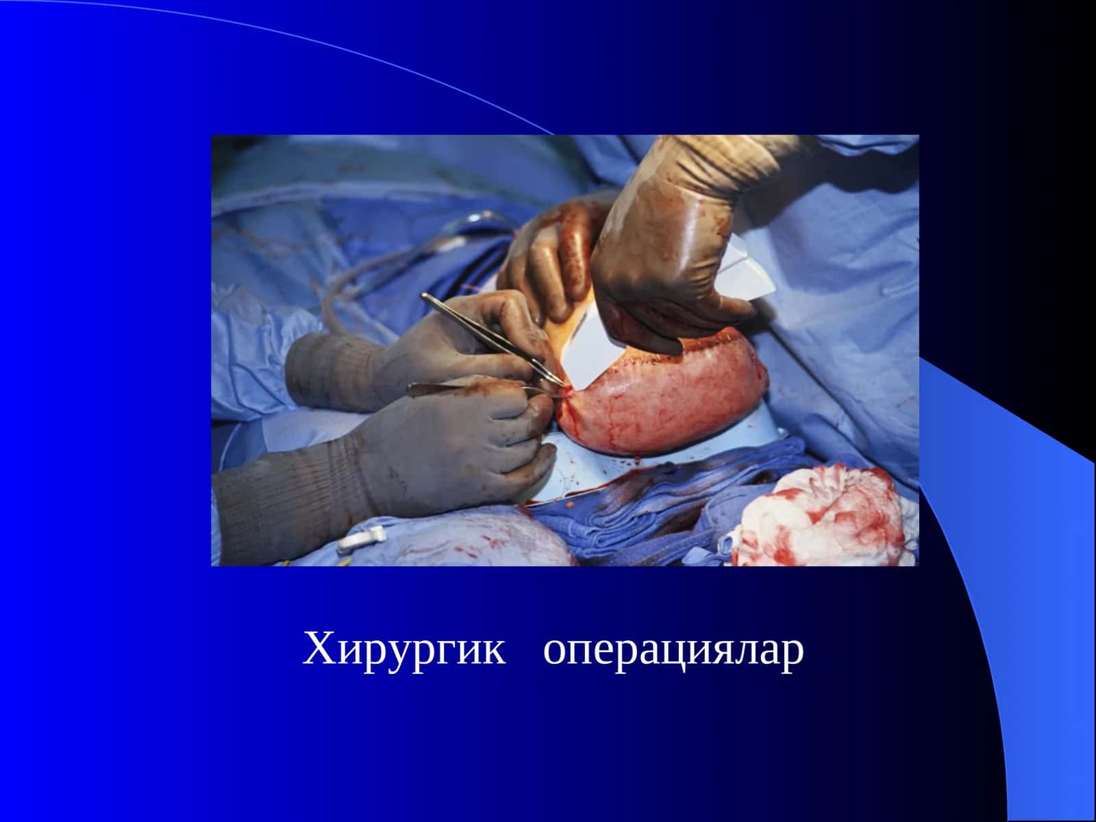 Хирургик операциялар