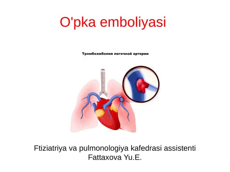O'pka emboliyasi