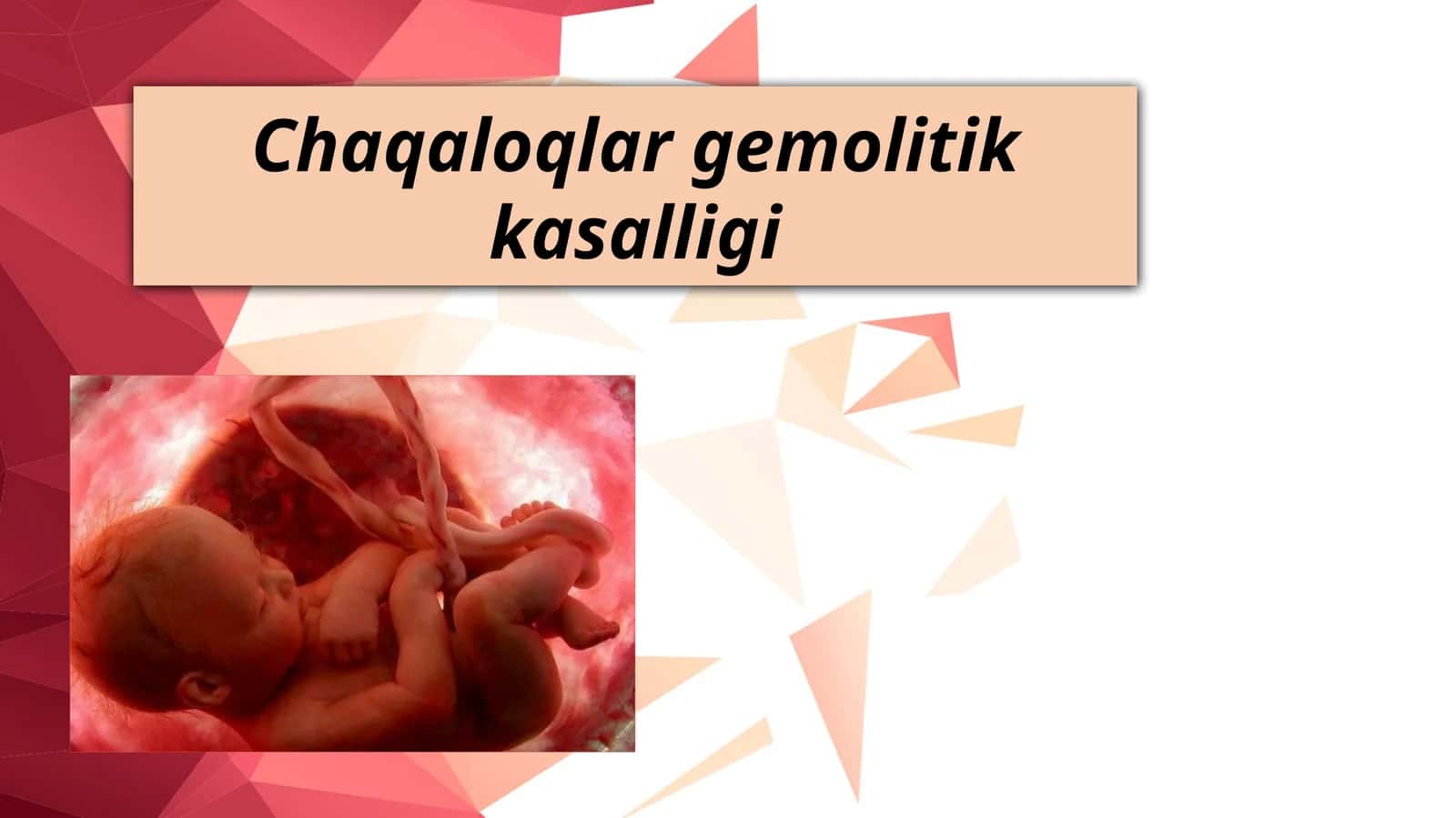 Chaqaloqlar gemolitik kasalligi