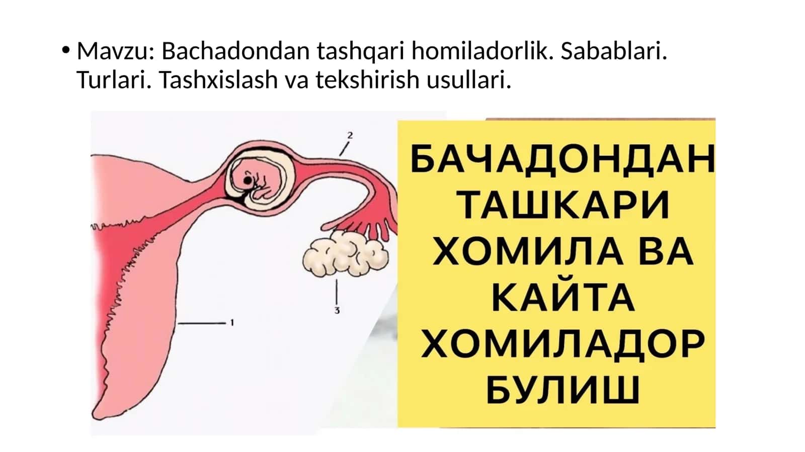 Bachadon-dantashqari homiladorlik