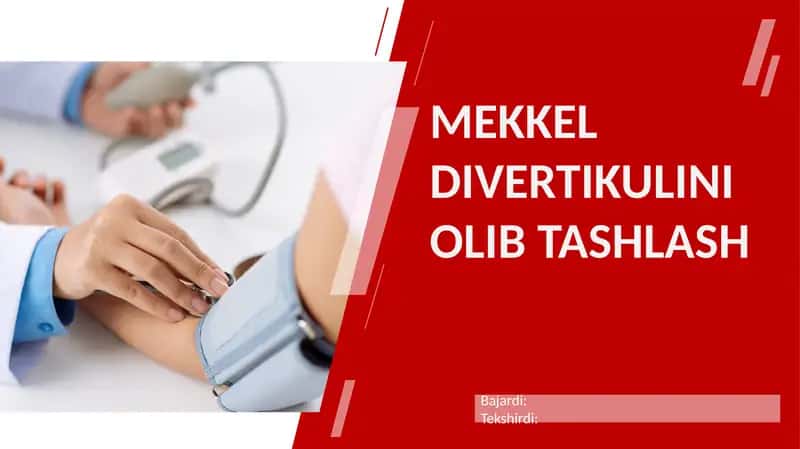 Mekkel Divertikulimi