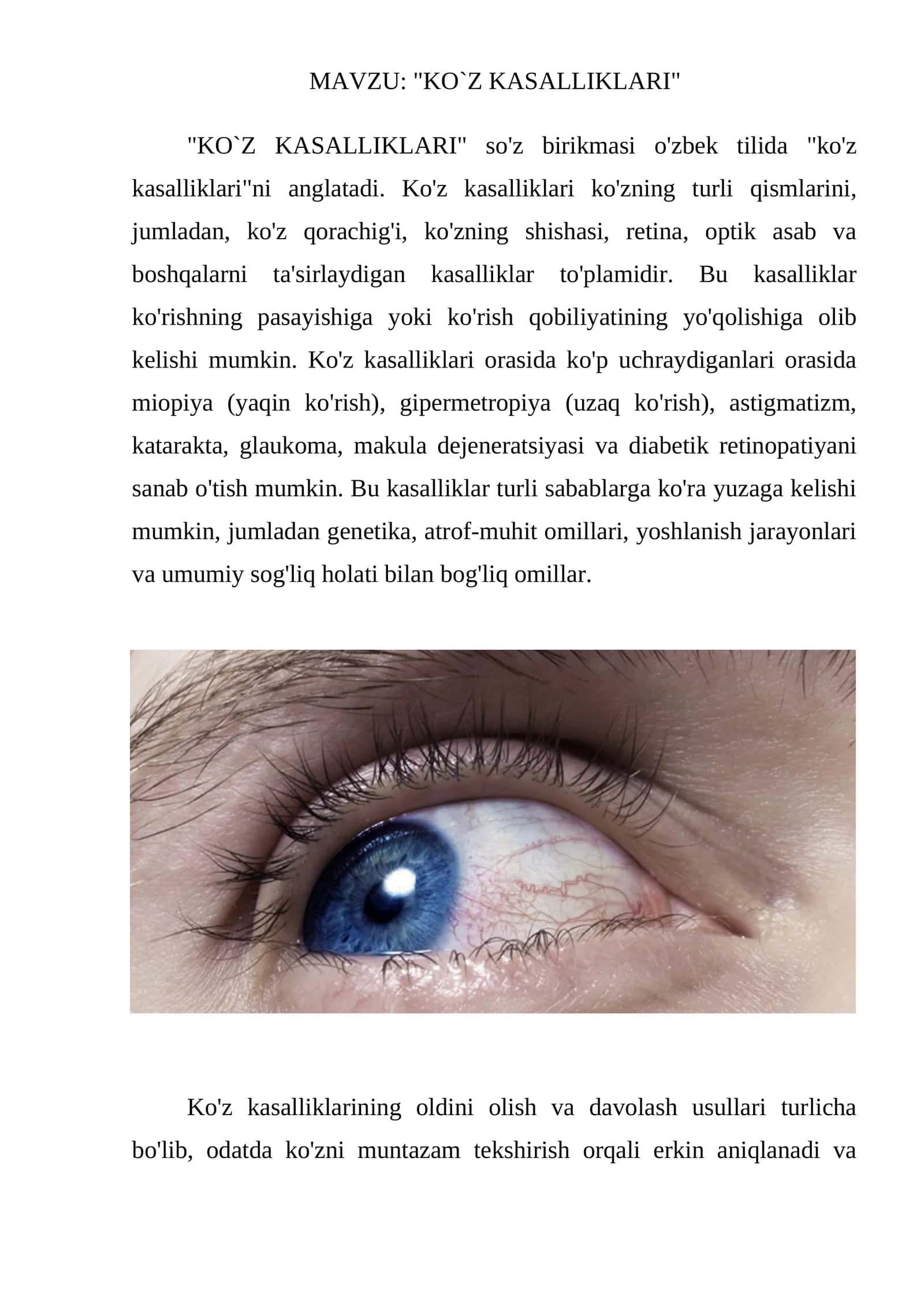 KO`Z KASALLIKLARI