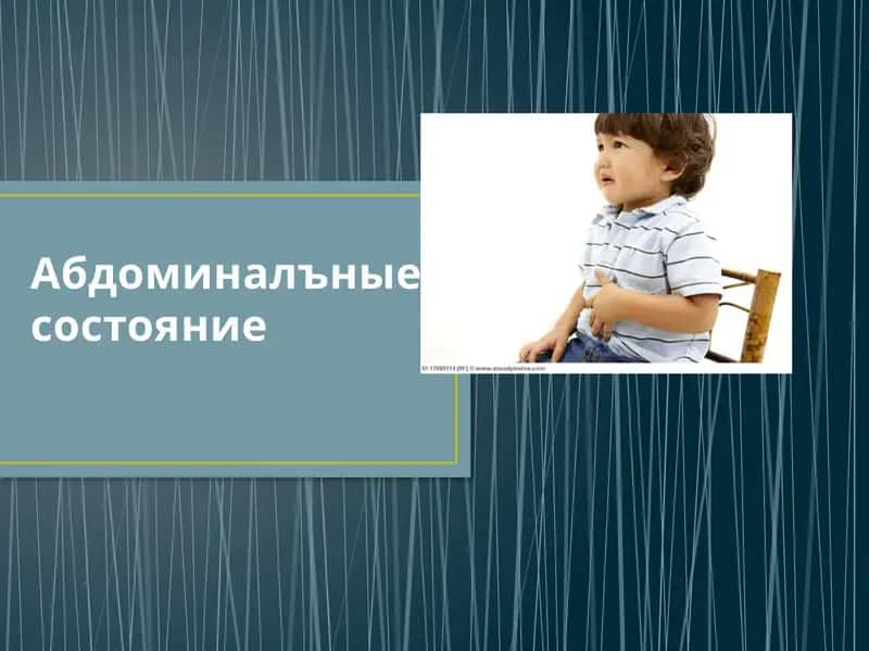 Болевой абдоминальный синдром