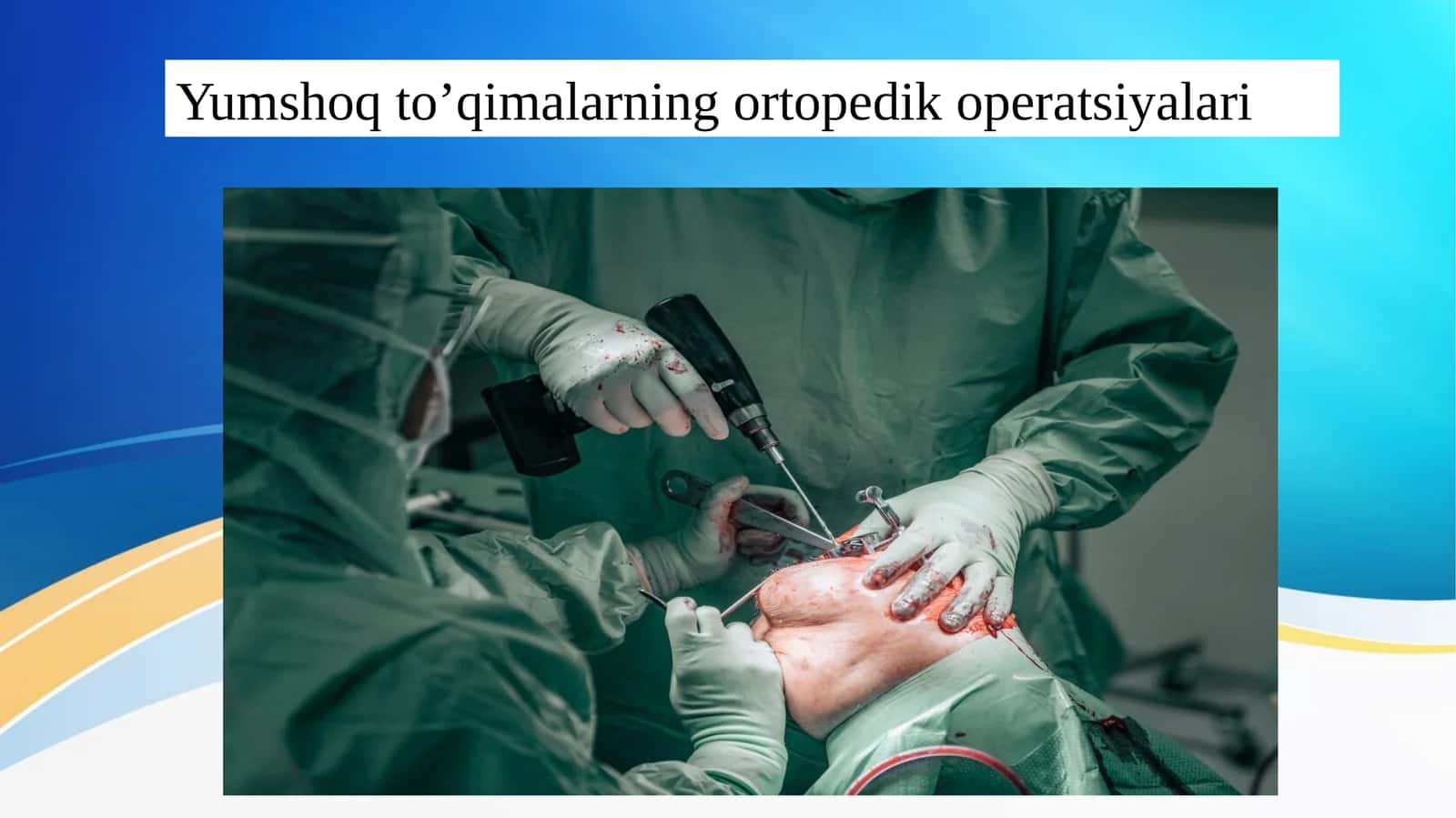Yumshoq to’qimalarning ortopedik operatsiyalari