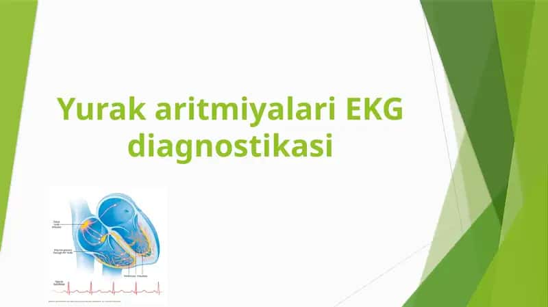 Yurak aritmiyalari EKG diagnostikasi