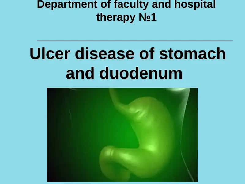Ulcer disease of stomach and duodenum