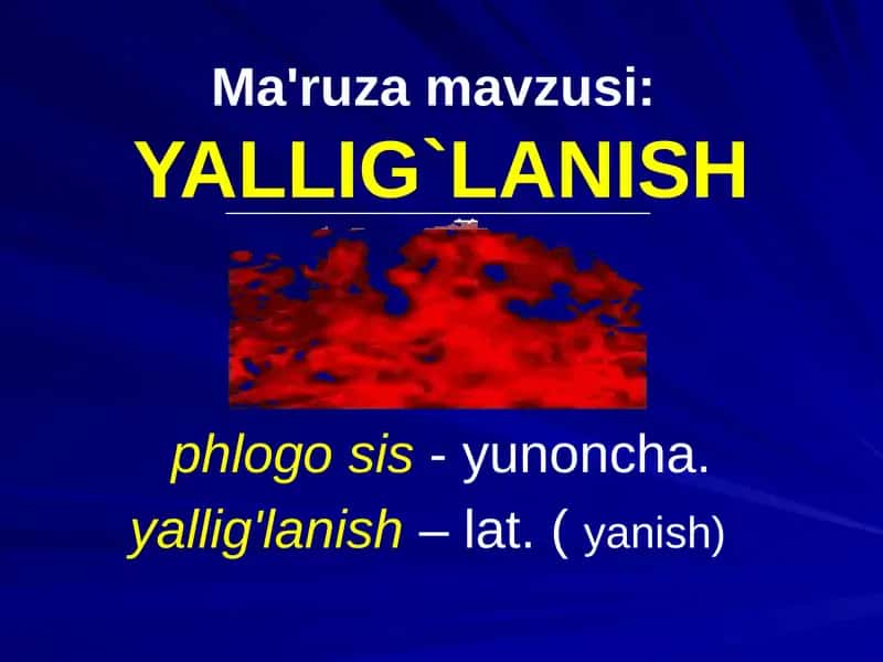 YALLIG`LANISH
