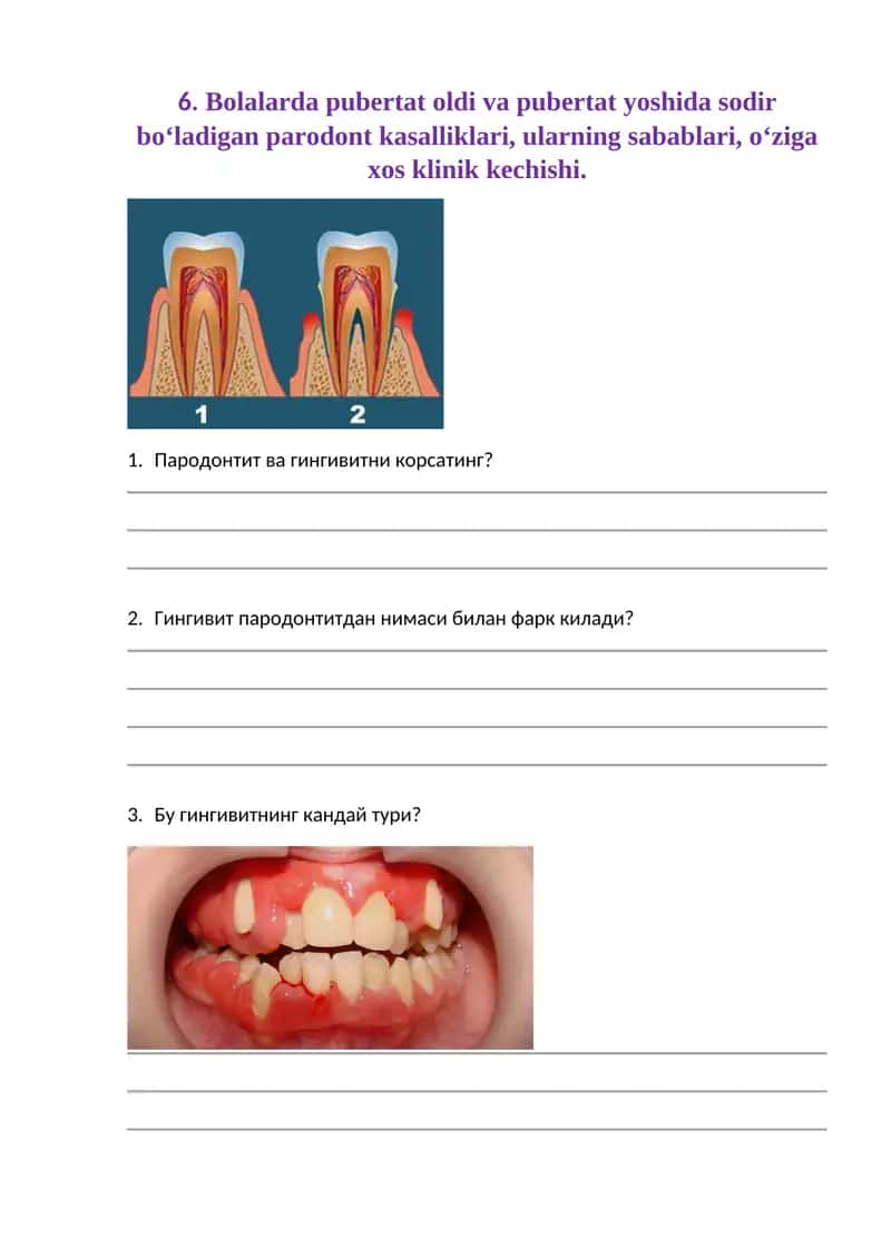 Bolalarda pubertat oldi va pubertat yoshida sodir bo‘ladigan parodont kasalliklari, ularning sabablari, o‘ziga xos klinik kechishi