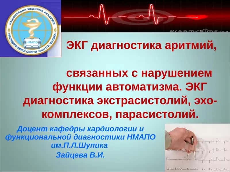 ЭКГ диагностика аритмий